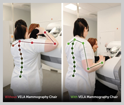 Vela mammography A
